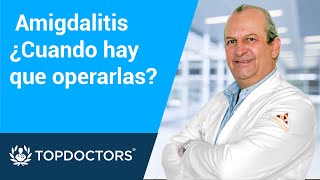 Amigdalitis ¿Cuándo hay que operarla  Top Doctors LATAM [upl. by Gorlicki]