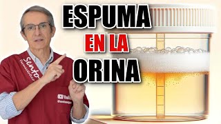 5 MOTIVOS principales de ESPUMA en la ORINA ¡Uno es ENFERMEDAD renal [upl. by Westleigh468]