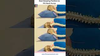 Best Sleeping Posture to fix Neck Hump Dowagers Hump neckpain fitnessmantram [upl. by Andre]