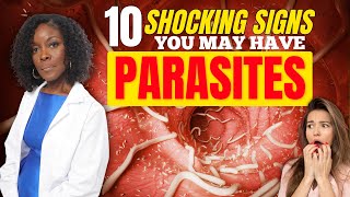 10 Shocking Signs You May Have Parasites [upl. by Iniffit]