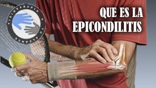 Epicondilitis o codo de tenista que es y como se produce [upl. by Croom]