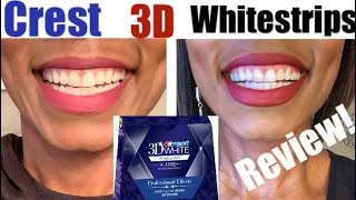 CREST 3D PROFESSIONAL WHITENING STRIPS REVIEW‼️ I whitened my teeth for 6 days‼️ [upl. by Eisen]