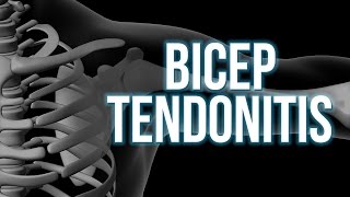 Bicep Tendonitis 3 steps to start the healing [upl. by Nahbois]