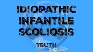 Idiopathic Infantile Scoliosis [upl. by Steady]