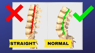 How To Correct Straightening Of Lumbar Spine FIX LOSS OF LUMBAR LORDOSIS  Dr Walter Salubro [upl. by Aggappora]