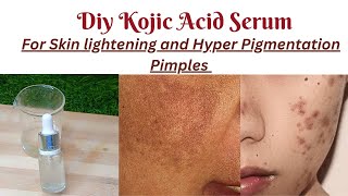 Diy Kojic Acid SerumHomemade Kojic Acid Serum makingKojic Acid Serum [upl. by Kcirdet543]