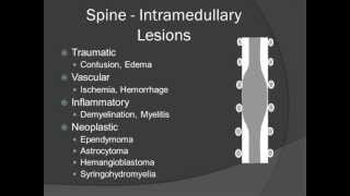 Localization of Spinal Masses  Introduction [upl. by O'Rourke]