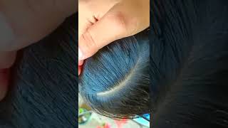 ASMR lice removal lice nits kuto kutu piojos [upl. by Dorsey547]