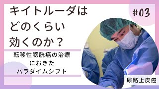 キイトルーダは膀胱癌にどのくらい効果があるのか。転移性膀胱癌治療に起きたパラダイムシフト [upl. by Nitaj]