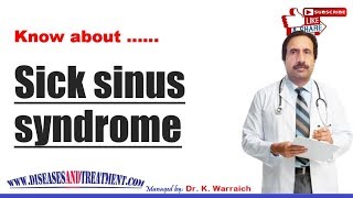 Sick sinus syndrome SSS  Causes Diagnosis Symptoms Treatment Prognosis [upl. by Brew]