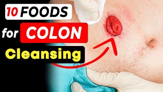 Top 10 Foods for Colon Cleansing Unlocking Gut Health🌟 [upl. by Asirap]