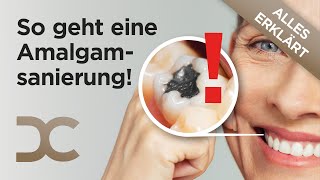 Amalgamsanierung Sicher Amalgam entfernen vor dem Zahnverlust  Risiken von Amalgamfüllungen [upl. by Eenrahc]