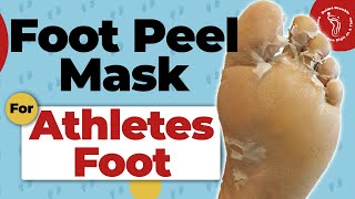 Foot Peel Mask Treatment For Athletes Foot [upl. by Lainahtan725]