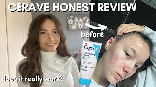 TESTING CERAVE FOR A MONTH SA SMOOTHING CREAM for TEXTURED SKIN [upl. by Tnattirb742]