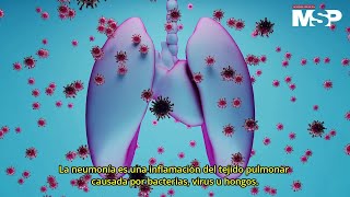 ¿Cómo se da la neumonía en los pulmones  ExclusivoMSP [upl. by Roshelle28]