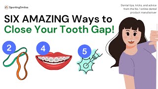 SIX AMAZING WAYS to Get Rid of that Tooth Gap [upl. by Neeneg]