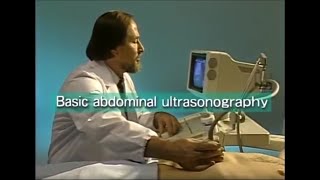 How to do abdominal ultrasound examination [upl. by Candra856]