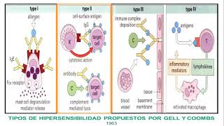 HIPERSENSIBILIDAD TIPO 2 RENE HADDAD [upl. by Enreval88]