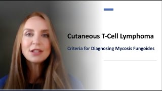 Criteria to Diagnose Mycosis Fungoides Chapter 1 [upl. by Roede]