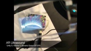 Ultrasound AR with Digital Eyewear [upl. by Hudis]