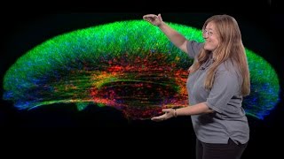 Julie Theriot Stanford HHMI 2 Mechanics and Dynamics of Rapid Cell Motility [upl. by Seana]