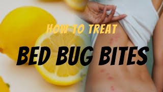 Bed Bug Bite Relief Effective Ways to Treat Bed Bug Bites  Remedies amp Tips [upl. by Haney777]