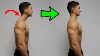 FIX Forward Head Posture Daily Corrective Routine [upl. by Neumann738]