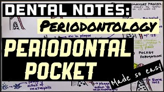 PERIODONTAL POCKET PART I II PERIODONTOLOGY II DENTAL NOTES II PATHOGENESIS II SO EASY [upl. by Showker212]