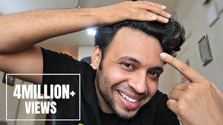 HOW I STOPPED MY HAIR FALL  क्या आपके बाल झड़ते है  ज़रूर देखिये  UrIndianConsumer [upl. by Fen706]