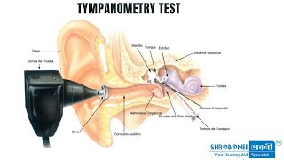 What is Tympanometry Impedance Audiometry How is Tympanometry Test done  hearingtest Bengali [upl. by Colene504]