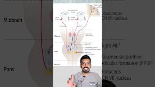 Internuclear Ophthalmoplegia concept explained in 3minutes [upl. by Atalayah627]