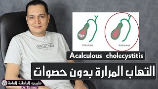 التهاب المرارة بدون حصوات  Acalculous cholecystitis [upl. by Norina]