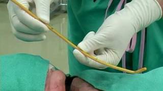 BougieAided Cricothyrotomy by Darren Braude [upl. by Taro325]