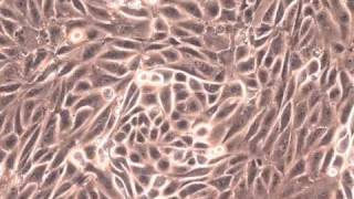 proliferating human kidney epithelial cell culture 1 [upl. by Finbur466]