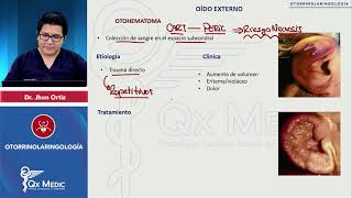 OTORRINOLARINGOLOGÍA Oído externo Otohematoma [upl. by Zollie]