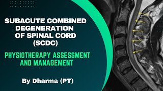 Subacute Combined Degeneration of Spinal Cord SCDC  Physiotherapy Assessment and Management [upl. by Naget]