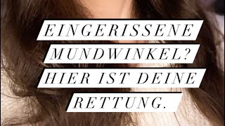 Eingerissene Mundwinkel Hier kommt deine Rettung [upl. by Russia]