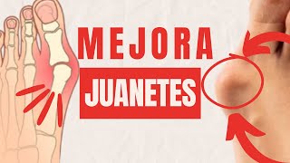 ¿JUANETES Mejóralos con estos ejercicios [upl. by Danielson]