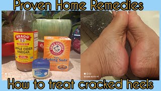 How To Use Apple Cider Vinegar and Baking Soda As A Treatment For Calluses and Cracked Heels [upl. by Ashlie568]