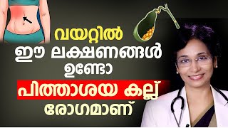 വയറ്റിൽ ഈ ലക്ഷണങ്ങൾ ഉണ്ടോ പിത്താശയ കല്ല് രോഗമാണ്  pithashayathil kallu  Arogyam [upl. by Yesmar]