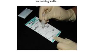 RapidVet H Canine Blood Typing Test [upl. by Anirazc]