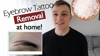 Eyebrow Tattoo Removal at Home How to remove Eyebrow Tattoos safely amp inexpensively [upl. by Ocana]