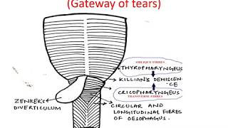 Zenkers Diverticulum  Hypopharyngeal Diverticulum  ENT Lecture Series [upl. by Drazze]