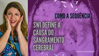 Como descobrir a Causa do hematoma cerebral usando a ressonância magnética [upl. by Colly]