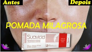 SUAVICID TUDO SOBRE A POMADA MILAGROSA PARA MANCHAS e MELASMA  SUAVICID ANTES E DEPOIS [upl. by Aitrop598]