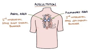 Heart Murmurs and Heart Sounds Visual Explanation for Students [upl. by Pincince]