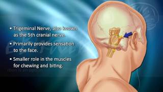 Understanding Trigeminal Neuralgia  eBrainMDcom [upl. by Neala]