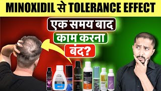 Minoxidil Not Working Anymore How to Beat the Tolerance Effect [upl. by Reede]