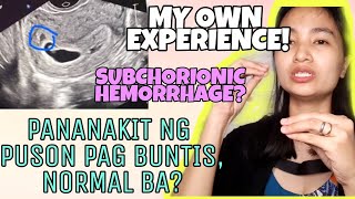 PANANAKIT NG PUSON PAG BUNTIS NORMAL BA  EXPERIENCE KO SA SUBCHORIONIC HEMORRHAGE [upl. by Erdne]