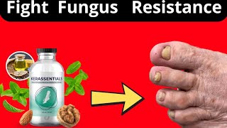 Kerassentials Review 2024 Nail Fungus Treatment [upl. by Tonye238]